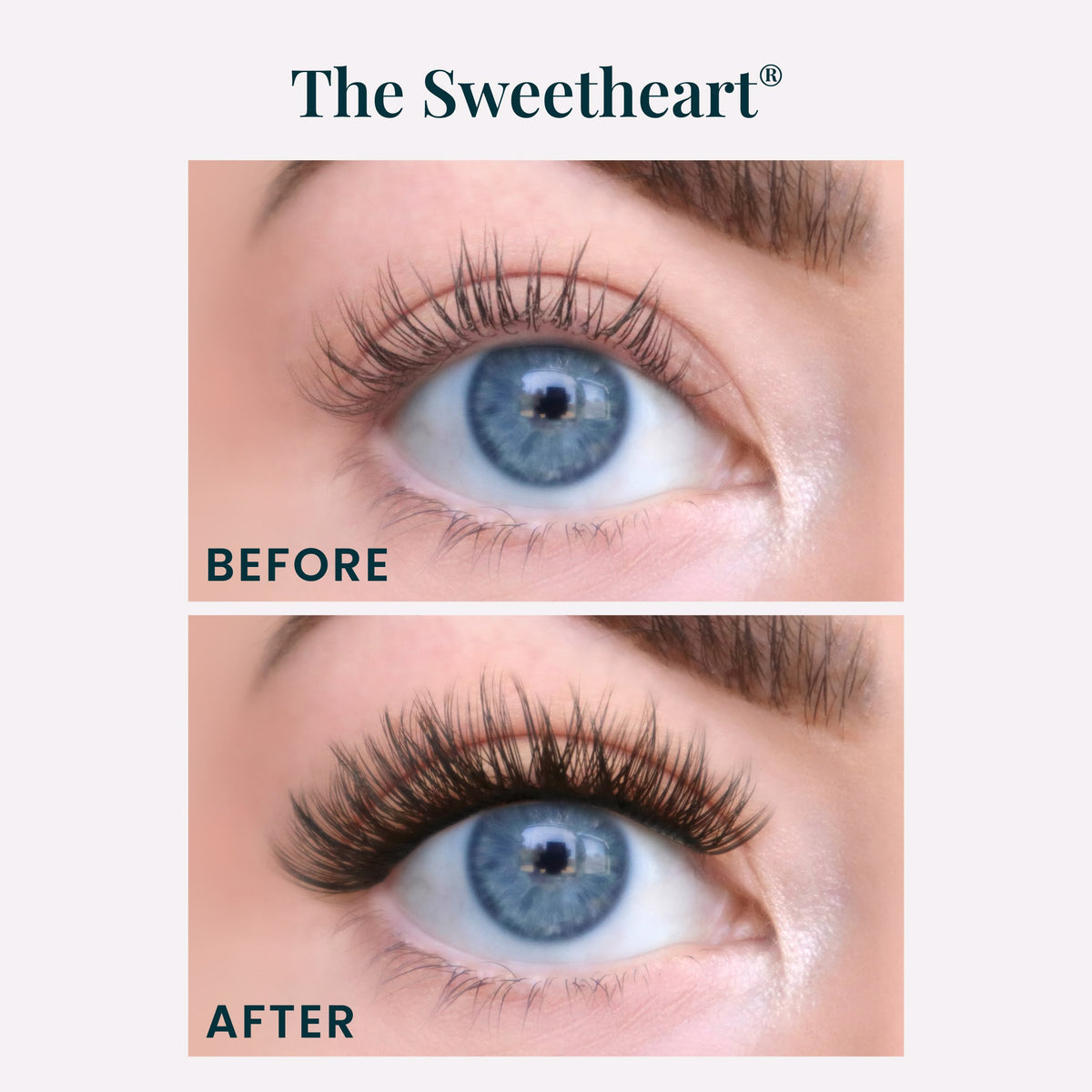 The Sweetheart® | Eye Crop B&A